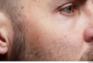 HD Face Skin Raul Conley cheek face skin pores skin…